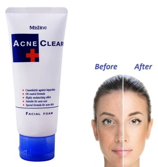 Sữa Rửa Mặt Cho Da Mụn Mistine Acne Clear Facial Foam Thái Lan 100ml - Ảnh 3